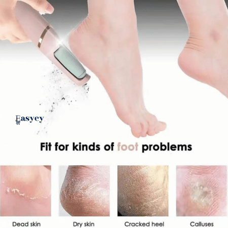 Instant Smooth Heels – Rechargeable Electric Callus Remover
